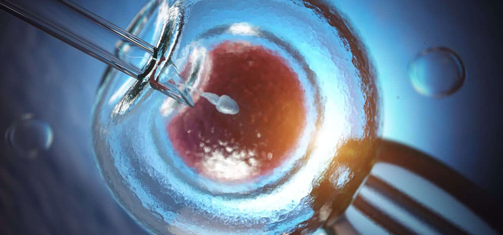 In Vitro Fertilization (IVF)